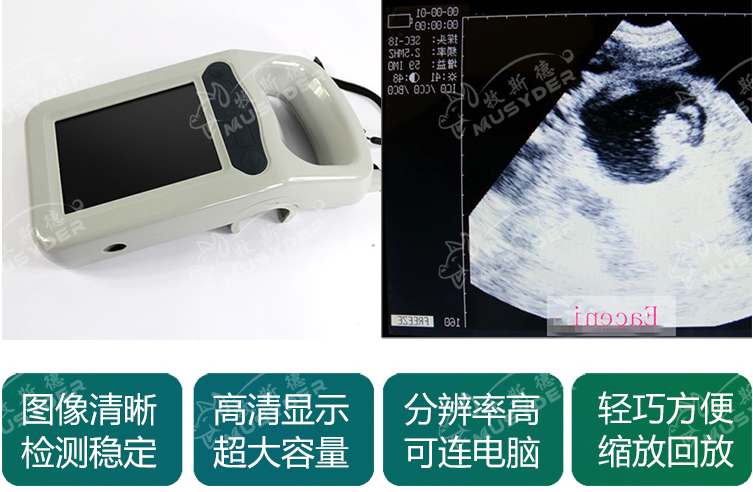 使用法國大歐B超監(jiān)測(cè)母豬